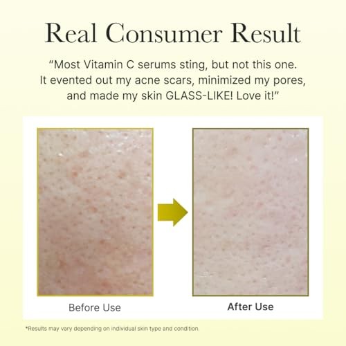 Arencia Vitamin C Booster Shot Serum with Glutathione, Niacinamide and Vitamin E for Glow Skin 1.01 Fl Oz
